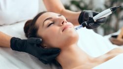 RF-Microneedling-Face-Lift